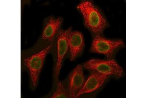 IF analysis of SBDS using anti-SBDS antibody (ABIN7600404) and anti-Beta Tubulin antibody (ABIN7602743). (SBDS anticorps  (AA 19-241))