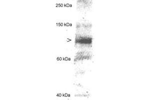 Western blot analysis of MLXIPL in 20 ug of human hepatocyte lysate using MLXIPL polyclonal antibody .