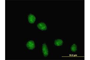 Immunofluorescence of purified MaxPab antibody to TRIM28 on HeLa cell.