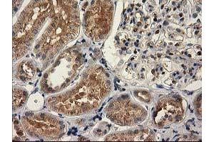 Immunohistochemical staining of paraffin-embedded Human Kidney tissue using anti-CAT mouse monoclonal antibody. (Catalase anticorps)