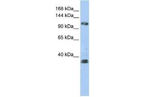 WB Suggested Anti-ZEB2 Antibody Titration:  0. (ZEB2 anticorps  (N-Term))