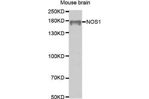 Western Blotting (WB) image for anti-Nitric Oxide Synthase 1, Neuronal (NOS1) (AA 1-180) antibody (ABIN6218566) (NOS1 anticorps  (AA 1-180))