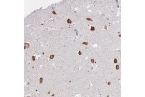 Immunohistochemical staining of human hippocampus with CTAGE5 polyclonal antibody  shows strong cytoplasmic positivity in neuronal cells. (MIA2 anticorps)