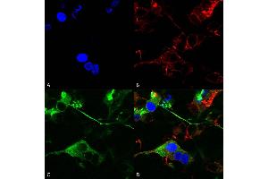 Immunocytochemistry/Immunofluorescence analysis using Mouse Anti-GABA-A Receptor Alpha 2 Monoclonal Antibody, Clone S399-19 (ABIN2485719).