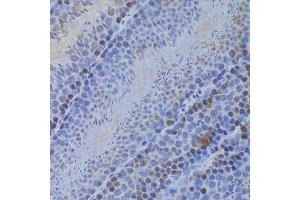 Immunohistochemistry of paraffin-embedded mouse testis using HELLS Antibody (ABIN5973444) at dilution of 1/100 (40x lens). (HELLS anticorps)
