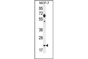 Western blot analysis of hCG_1646420 Antibody (Center) in MCF-7 cell line lysates (35ug/lane). (CLDN25 anticorps  (Middle Region))
