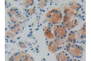 Detection of GDI1 in Human Stomach Tissue using Polyclonal Antibody to GDP Dissociation Inhibitor 1 (GDI1) (GDI1 anticorps  (AA 1-274))