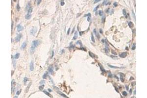 Immunohistochemical staining of formalin-fixed paraffin-embedded human skin tissue with ADAMTS3 polyclonal antibody  at 1 : 100 dilution. (ADAMTS3 anticorps  (C-Term))