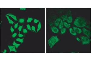 Immunofluorescence (2μg/ml) staining of methanol-fixed HeLa before (left) and after (right) introduction of siRNA. (SPG20 anticorps  (Internal Region))