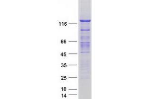 Validation with Western Blot (Smoothelin Protein (SMTN) (Transcript Variant 2) (Myc-DYKDDDDK Tag))