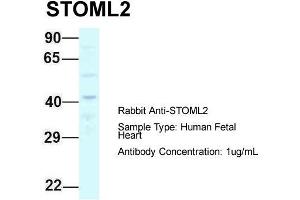 Host: Rabbit  Target Name: STOML2  Sample Tissue: Human Fetal Heart  Antibody Dilution: 1. (STOML2 anticorps  (C-Term))