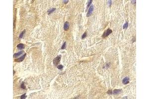 Immunohistochemistry of ECSIT in mouse heart cells with ECSIT antibody at 2 μg/ml.