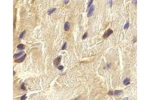 Immunohistochemistry of ECSIT in mouse heart cells with ECSIT antibody at 2 μg/ml. (ECSIT anticorps  (C-Term))