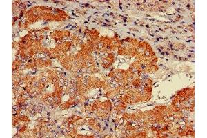 IHC image of ABIN7146261 diluted at 1:600 and staining in paraffin-embedded human adrenal gland tissue performed on a Leica BondTM system. (CHP anticorps  (AA 2-195))