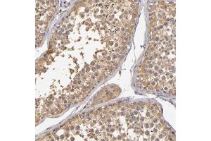 Immunohistochemical staining (Formalin-fixed paraffin-embedded sections) of human testis with GNPDA1 polyclonal antibody  shows moderate cytoplasmic positivity in germ cells at 1:200 - 1:500 dilution. (GNPDA1 anticorps)