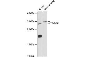 Western blot analysis of extracts of various cell lines, using LIME1 antibody (ABIN6128200, ABIN6143228, ABIN6143229 and ABIN6217817) at 1:3000 dilution.