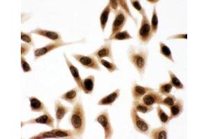 ICC testing of HeLa cells (BUB3 anticorps  (Middle Region))