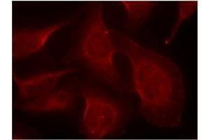 Image no. 1 for anti-BCL2-Like 11 (Apoptosis Facilitator) (BCL2L11) (pSer65), (pSer69) antibody (ABIN197056)