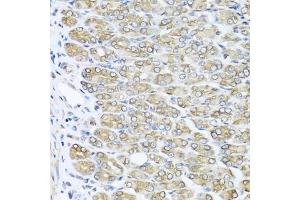 Immunohistochemistry of paraffin-embedded mouse stomach using R antibody (ABIN3021523, ABIN3021524, ABIN3021525 and ABIN6215193) at dilution of 1:100 (40x lens). (RAC2 anticorps  (AA 1-192))