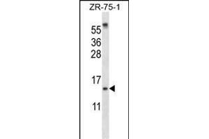 SUMO1 Antibody (N-term) (ABIN657634 and ABIN2846630) western blot analysis in ZR-75-1 cell line lysates (35 μg/lane). (SUMO1 anticorps  (N-Term))