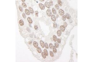 Immunohistochemistry (IHC) image for anti-Cyclin L1 (CCNL1) (AA 350-400) antibody (ABIN7448508)