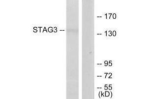 Western blot analysis of extracts from Jurkat cells, using STAG3 antibody. (STAG3 anticorps  (C-Term))