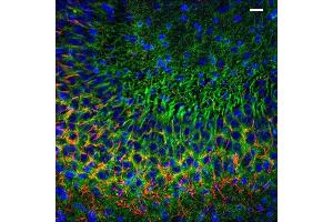Immunolabeling of postnatal 14 mouse CA3 specifically labeling PSD93 (Cat no (ABIN1304598), 1:400, green) and Ankyrin G(red). (DLG2 anticorps  (AA 1-852))