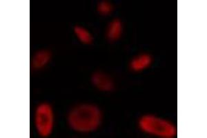 ABIN6272448 staining HT29 by IF/ICC. (Protein Tob1 (TOB1) (Internal Region) anticorps)
