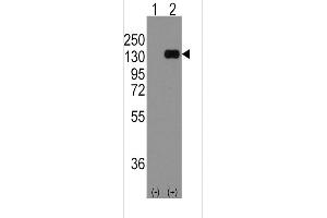 Western blot analysis of CDH1 using rabbit polyclonal CDH1 Antibody using 293 cell lysates (2 ug/lane) either nontransfected (Lane 1) or transiently transfected with the CDH1 gene (Lane 2).