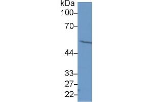 Western Blot; Sample: Human Hela cell lysate; Primary Ab: 1µg/ml Rabbit Anti-Human FSCN Antibody Second Ab: 0. (Fascin anticorps  (AA 277-396))