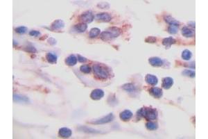 Image no. 1 for anti-Transforming Growth Factor, beta 1 (TGFB1) antibody (ABIN465317)