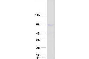 Validation with Western Blot