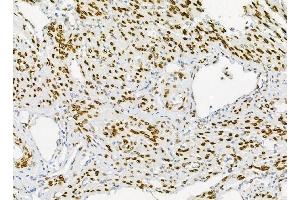 IHC analysis of Emerin using anti-Emerin antibody (ABIN4886569). (Emerin anticorps  (N-Term))