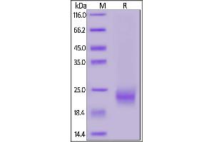Biotinylated Human IL-5, His,Avitag on  under reducing (R) condition.