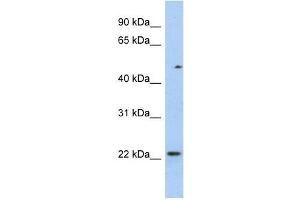 TCEAL3 antibody used at 0.