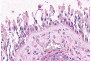 Immunohistochemical (Formalin/PFA-fixed paraffin-embedded sections) staining in human nasal mucosa, respiratory epithelium with OR2A4 polyclonal antibody . (OR2A4 anticorps  (3rd Cytoplasmic Domain))
