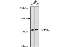 Western blot analysis of extracts of various cell lines, using S antibody (ABIN7270142) at 1:1000 dilution. (SAMHD1 anticorps)