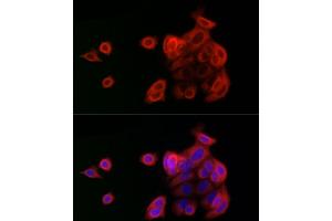 Immunofluorescence analysis of MCF7 cells using OP antibody (ABIN6129426, ABIN6145031, ABIN6145032 and ABIN6225150) at dilution of 1:100 (40x lens).