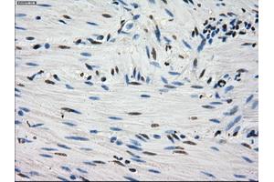 Immunohistochemical staining of paraffin-embedded Kidney tissue using anti-FHmouse monoclonal antibody. (FH anticorps)