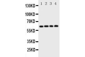 Anti-SQSTM1/p62 antibody, Western blotting Lane 1: Rat Brain Tissue Lysate Lane 2: HELA Cell Lysate Lane 3: U87 Cell Lysate Lane 4: A549 Cell Lysate