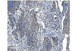 IHC analysis of NRF1 using anti-NRF1 antibody (ABIN7600874).