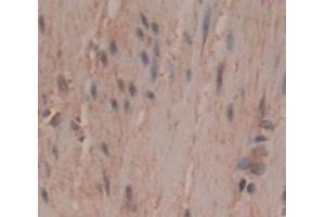 Figure. (CLMP anticorps  (AA 19-183))