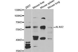 Western blot analysis of extracts of various cell lines, using ALAS2 antibody (ABIN5973907) at 1/1000 dilution. (ALAS2 anticorps)