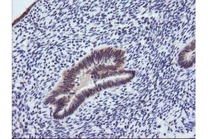 Image no. 1 for anti-Phosphoinositide-3-Kinase, Regulatory Subunit 5 (PIK3R5) antibody (ABIN1500212)