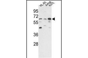 Western blot analysis of hP3CC-E33 (ABIN392895 and ABIN2837849) in HL-60, Jurkat,  cell line lysates (35 μg/lane). (PPP3CC anticorps  (N-Term))