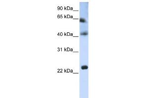 WB Suggested Anti-TSPAN3 Antibody Titration:  0. (Tetraspanin 3 anticorps  (Middle Region))