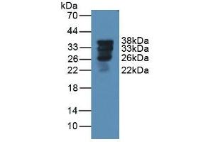 Detection of SFTPA1 in Rat Lung Tissue using Polyclonal Antibody to Pulmonary Surfactant Associated Protein A1 (SFTPA1) (Surfactant Protein A1 anticorps  (AA 21-248))