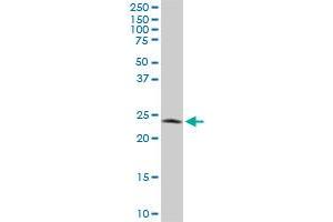 PGRMC2 monoclonal antibody (M04), clone 3C11.