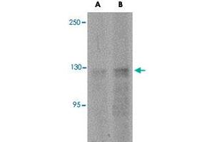 Western blot analysis of ANO2 in rat brain tissue lysate with ANO2 polyclonal antibody  at (A) 1 and (B) 2 ug/mL . (Anoctamin 2 anticorps  (N-Term))