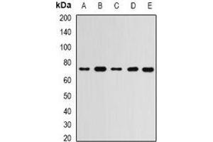 Western blot analysis of RBBP5 expression in MCF7 (A), Hela (B), mouse spleen (C), mouse brain (D), rat liver (E) whole cell lysates. (RBBP5 anticorps)